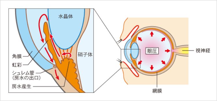 眼圧の図解