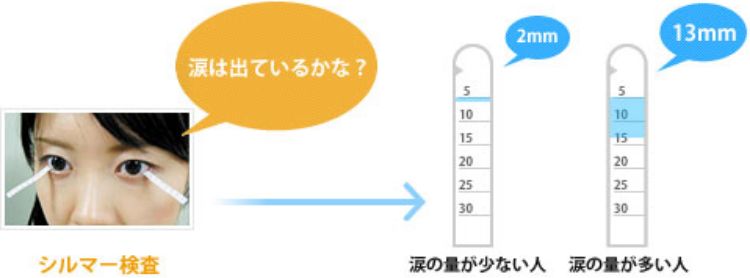 シルマー検査、涙の量が少ない人と多い人の比較イメージ画像