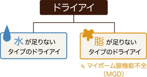 ドライアイ 水が足りアイタイプのドライアイ・脂が足りないタイプのドライアイ≒マイボーム腺機能不全（MGD）