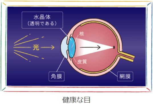 健康な目 水晶体（透明である）