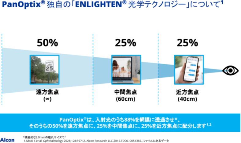 PanOptix®独自の「ENLIGHTEN®光学テクノロジー」について